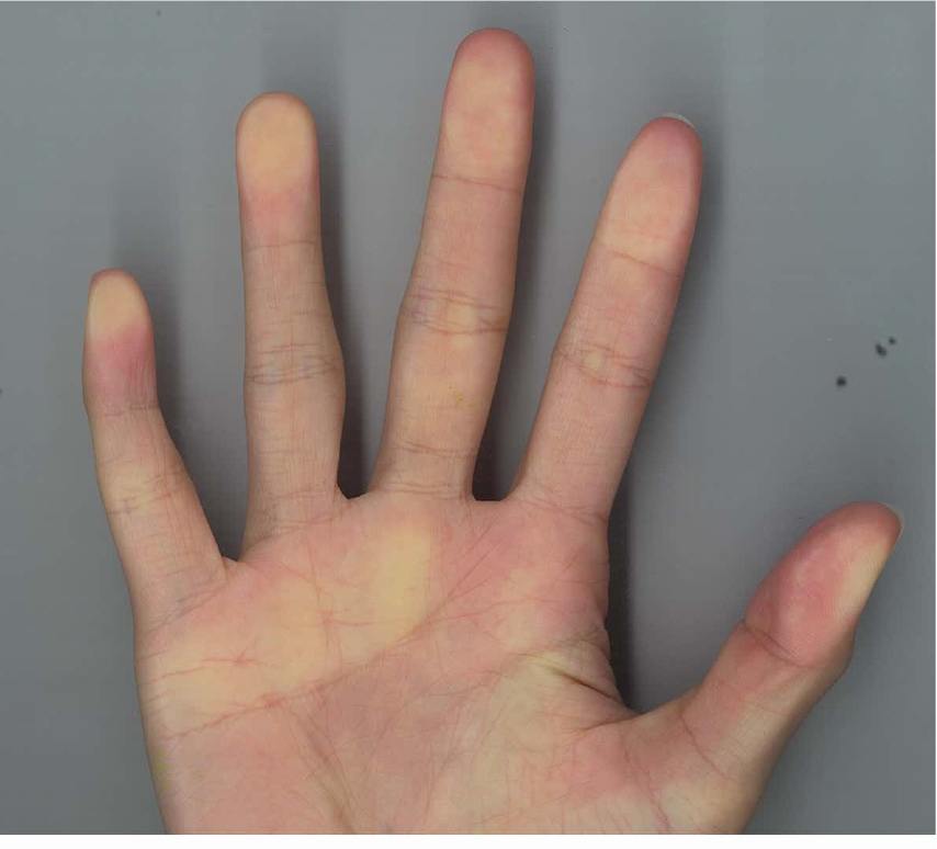 RightH.jpg RightH.jpg