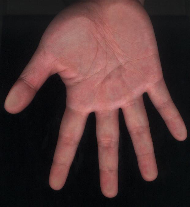 2879347-右手心.JPG