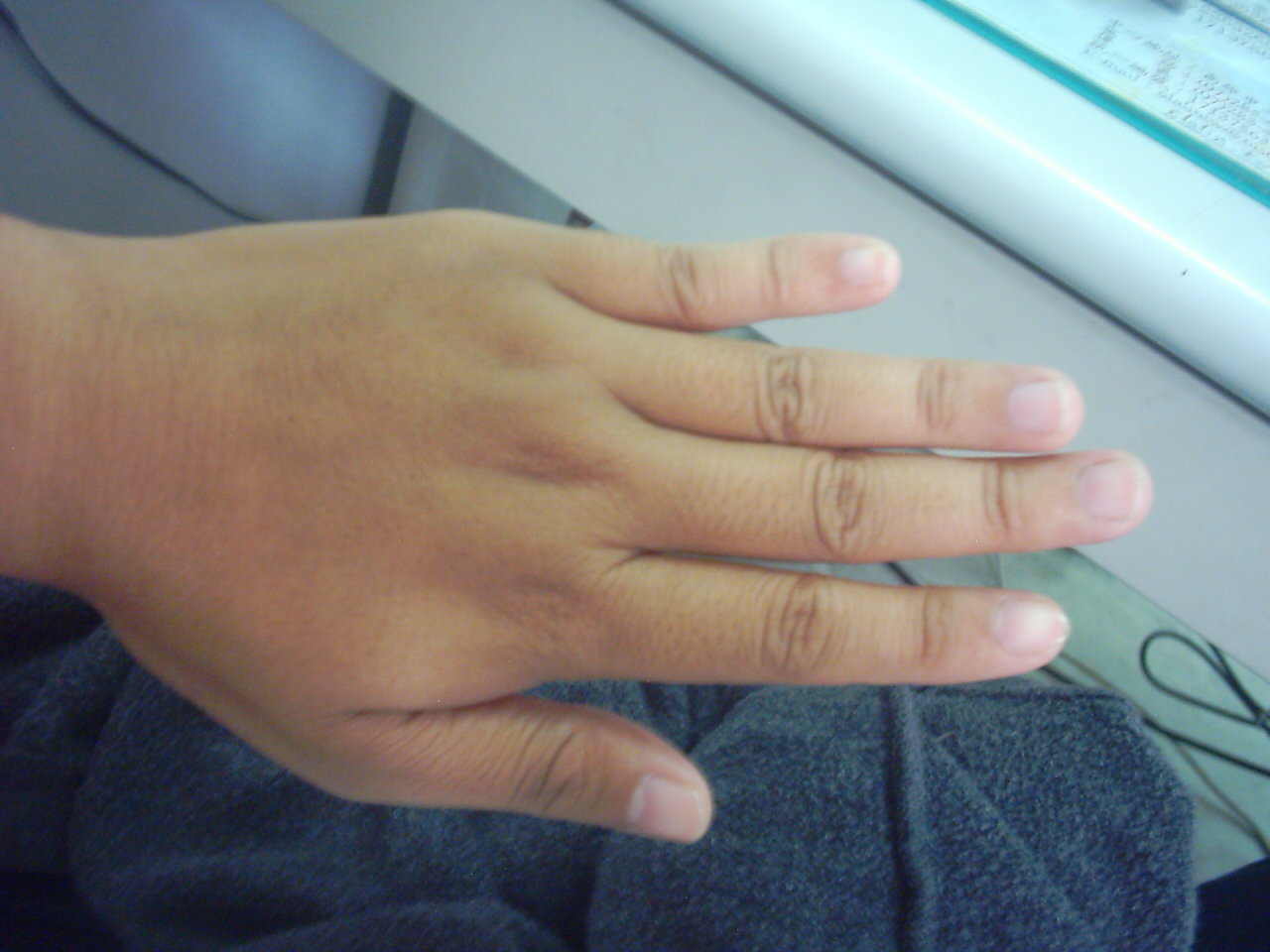 684506-左手手背.JPG
