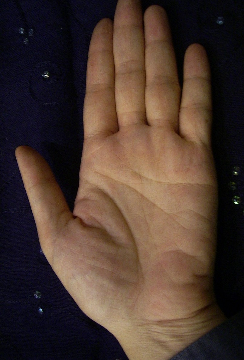 624322-My left hand.jpg