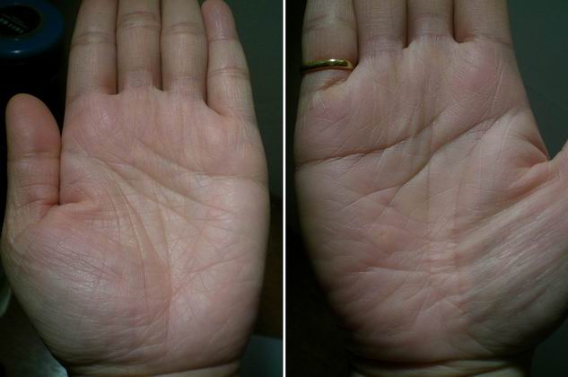 Resize of 兩手掌近照.jpg