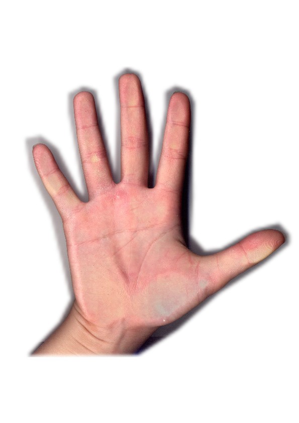 1331406-左手掌1.jpg