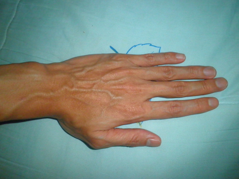 左掌背面.jpg