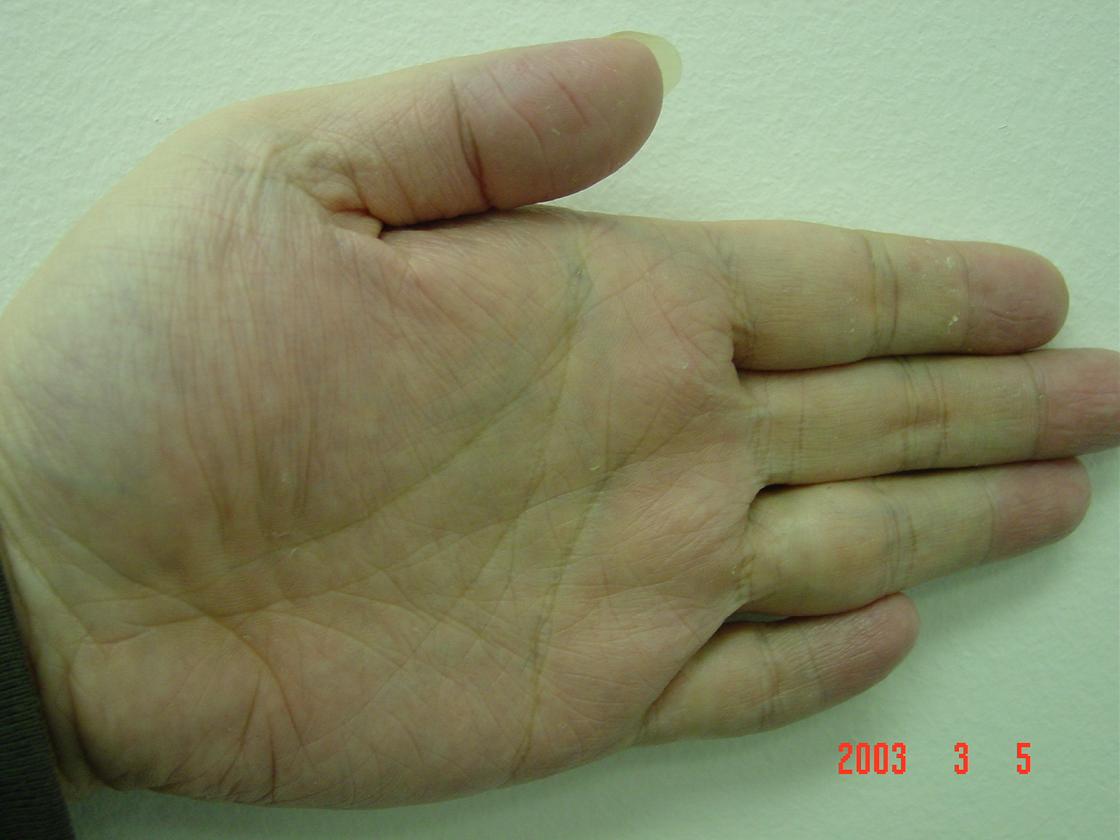 229403-hand1.JPG
