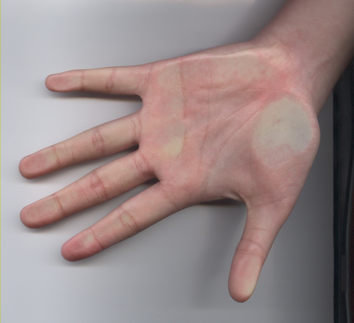 259796-left palm.JPG