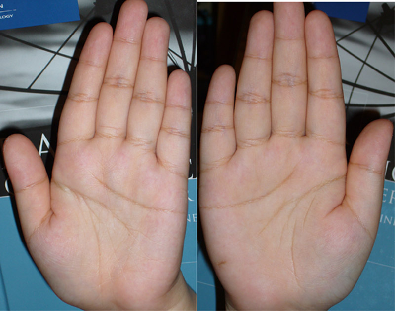 3399004-hand.jpg