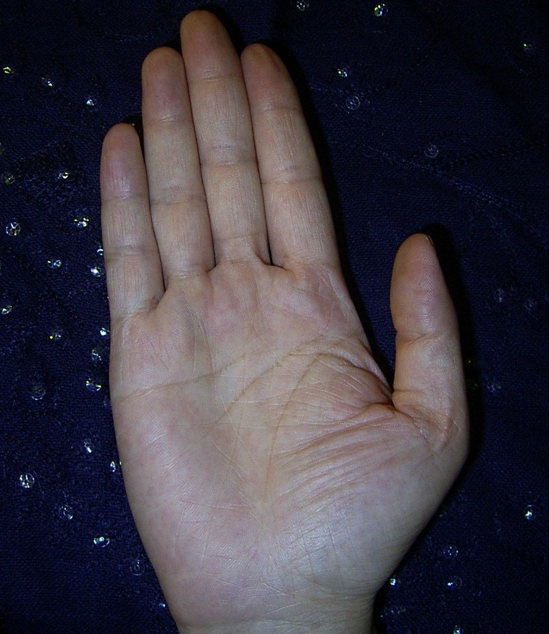 624320-My right hand.JPG