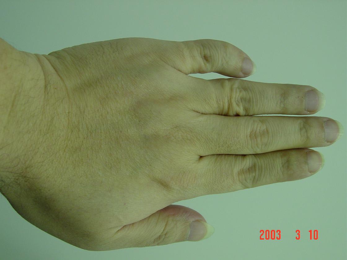 232347-hand2.JPG