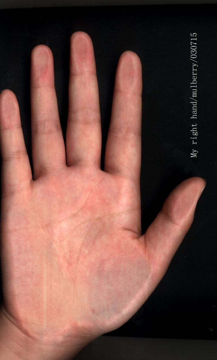 310205-030715 my right hand.jpg