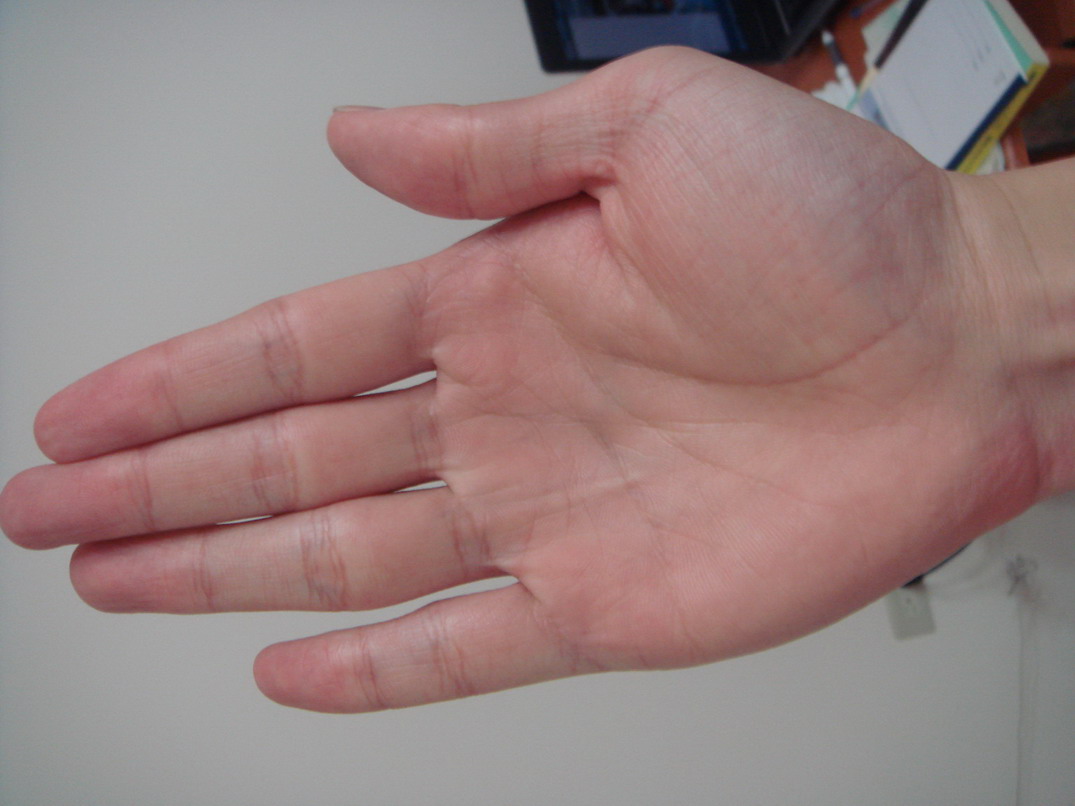 右手.JPG