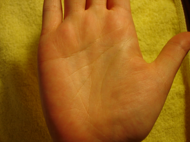 763590-Right-Clear Palm.jpg