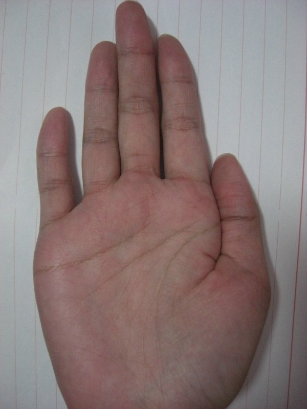 3351210-右掌.JPG