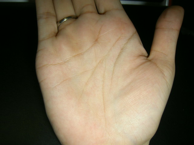 2107512-右掌心.JPG