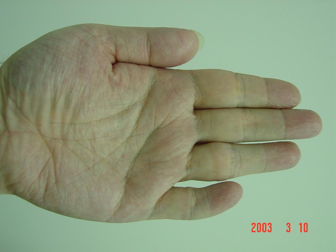 232340-hand1.JPG