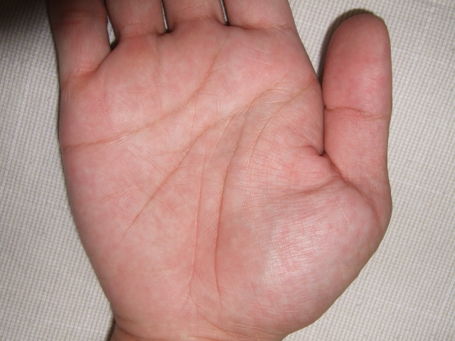 3294876-右手心近.JPG